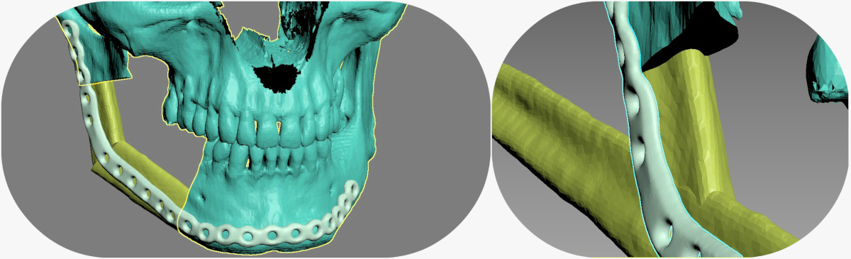 3dmodel with plate